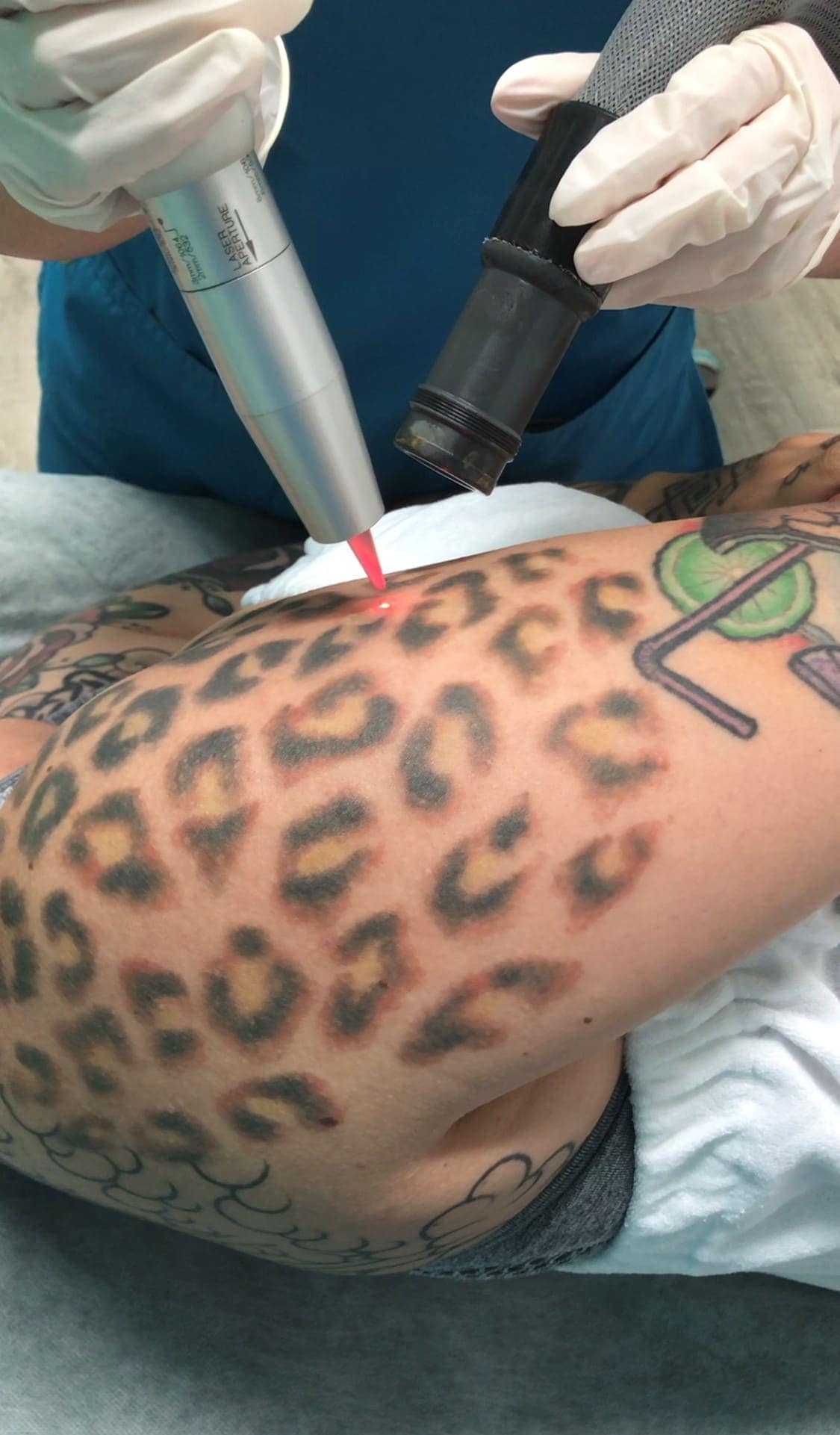 In The Media | D'MARGE: Best Tattoo Removal Clinics in Sydney | Contour  Clinics